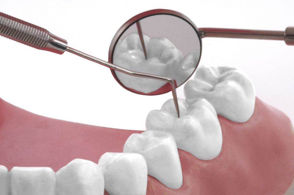 Finding The Perfect Dentist Around Wood Dale