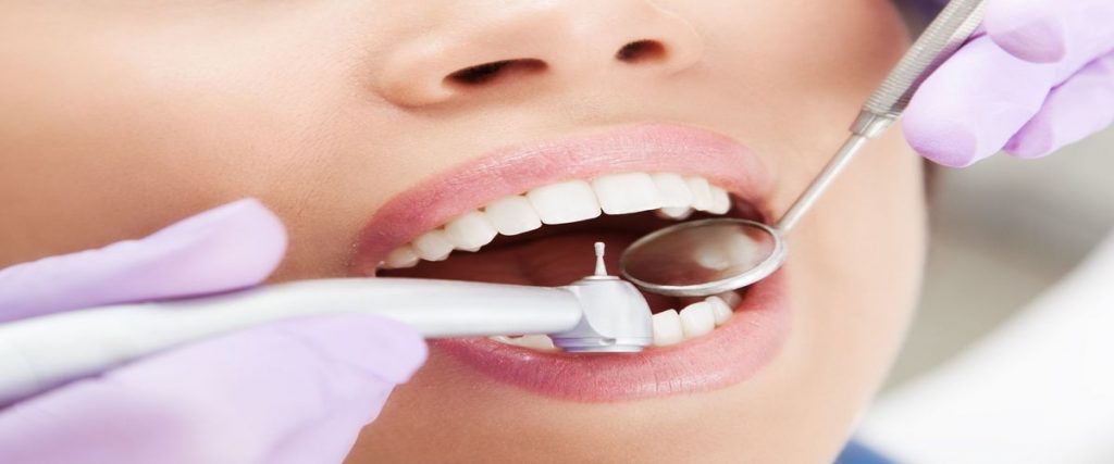 Dental Implant Treatment in Troy MI