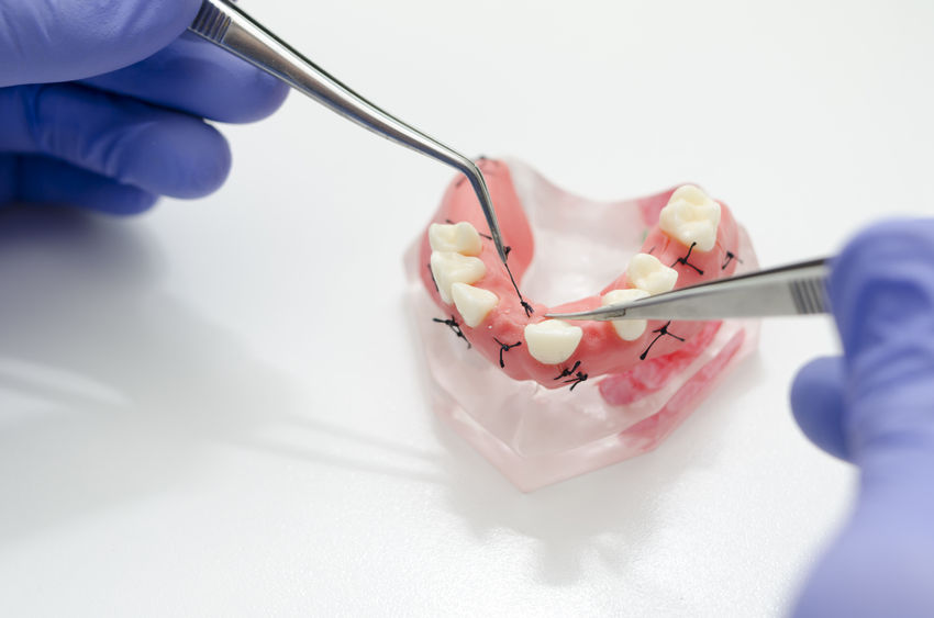 Emergency Dentist Round Lake Beach – Reilly & Siegel Family Dental