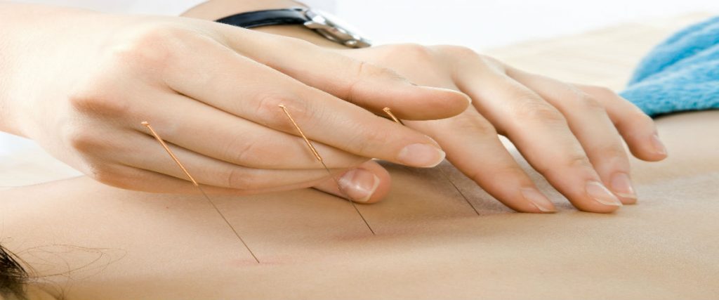 Choose The Right Traditional Chinese Medicine University in San Jose CA