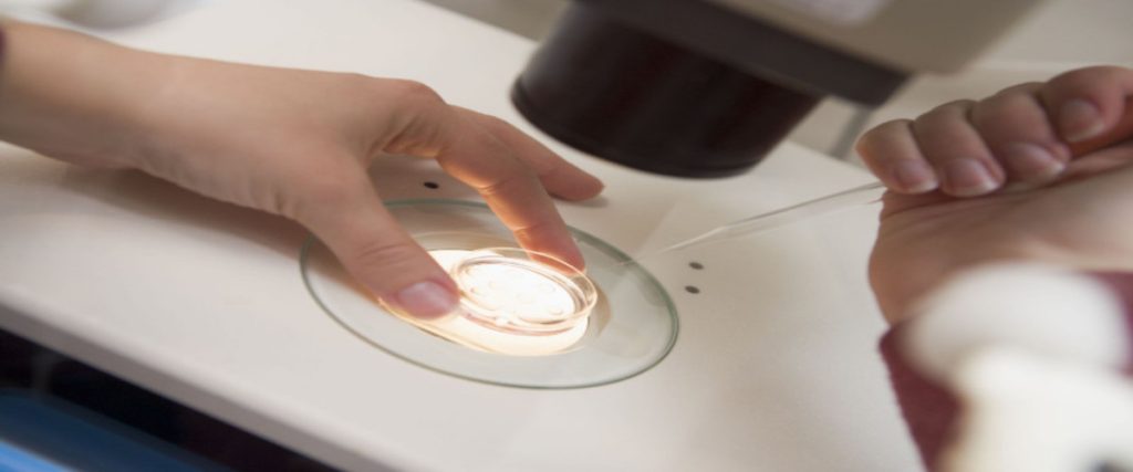 How Male factor infertility is recognized and treated