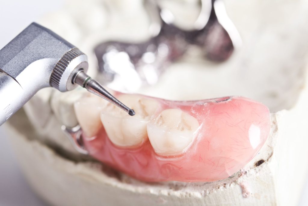 Smile Exchange of Hatfield Provides Root Canal Therapy In Hatfield PA.