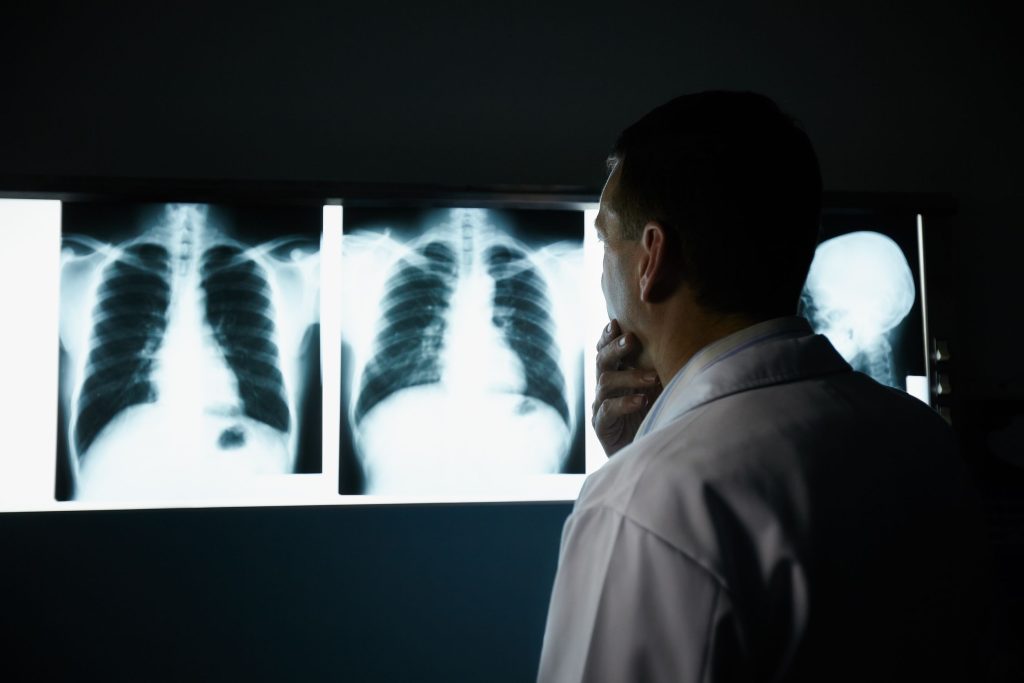 Mammogram Screening Buffalo NY